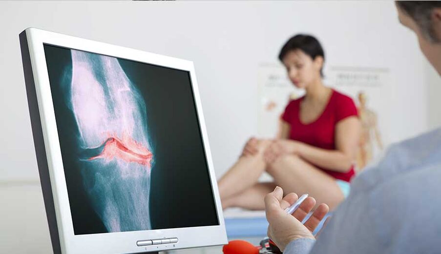 Consulta con un médico si se sospecha artritis o artrosis