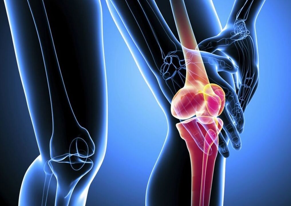 Dolor durante la actividad física en la artrosis de la articulación de la rodilla
