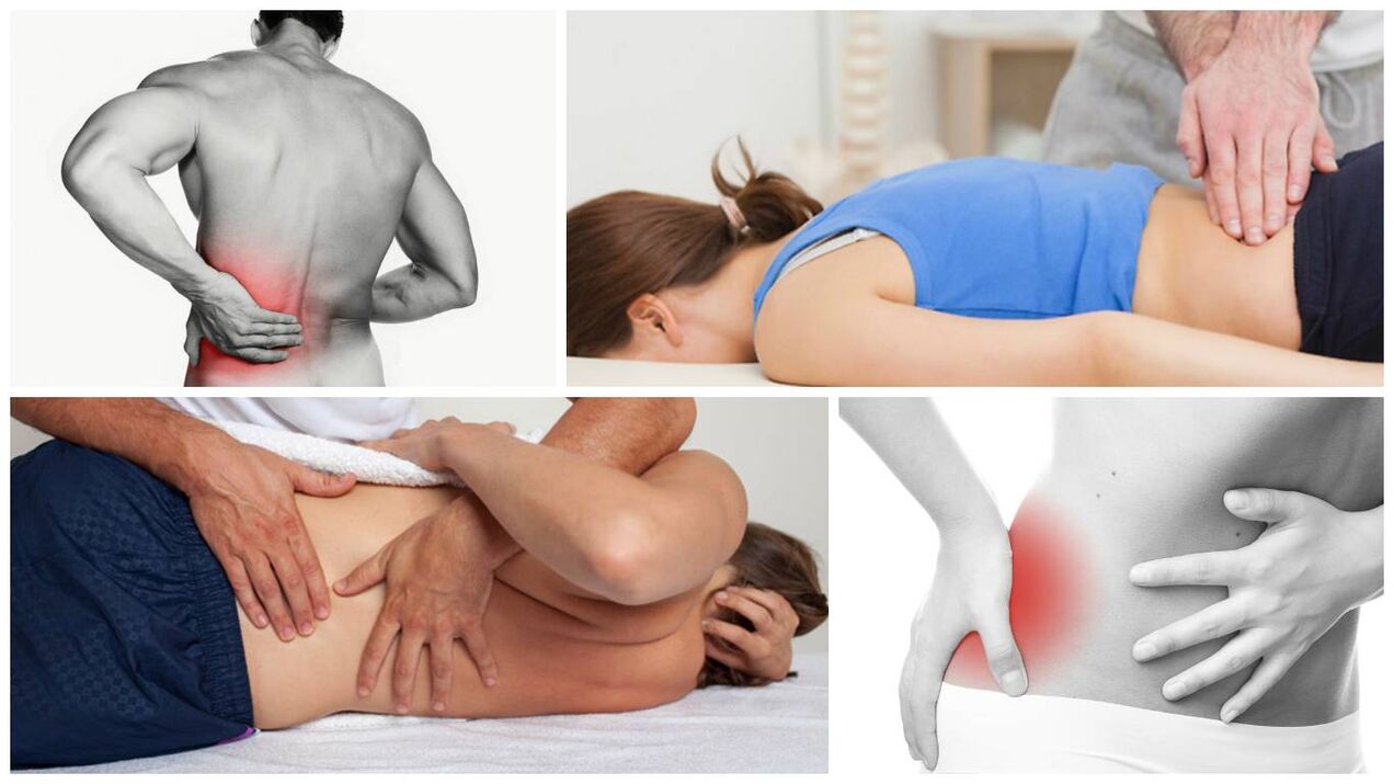 Síntomas y causas del dolor de espalda. 