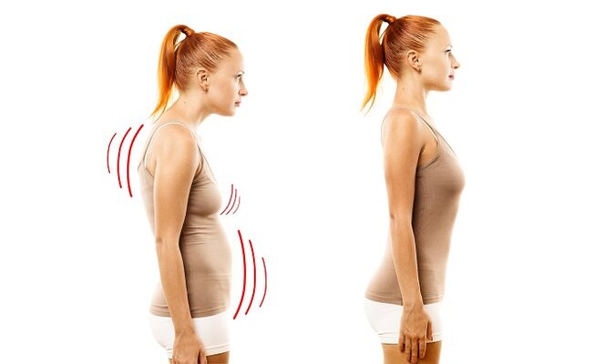 inclinado como la causa del desarrollo de la osteocondrosis lumbar