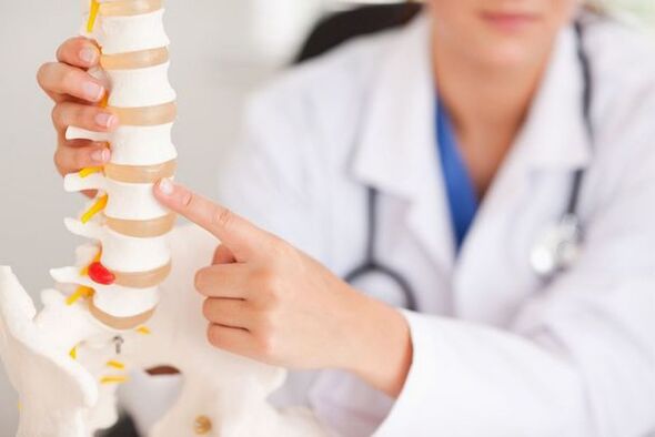 El médico demuestra un modelo de la columna.