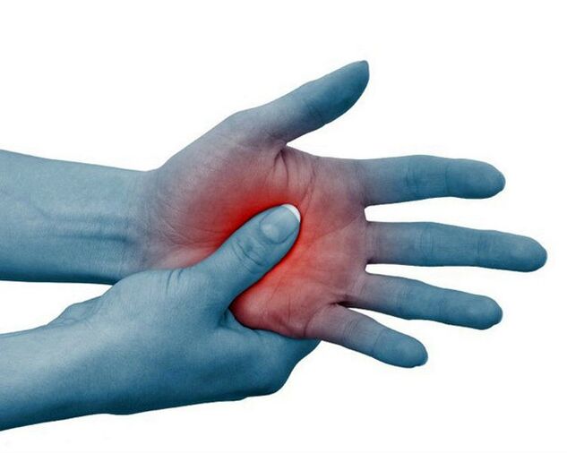 El dolor intenso en las articulaciones de los dedos, que disminuye con el ejercicio, es un signo típico de artritis reumatoide.